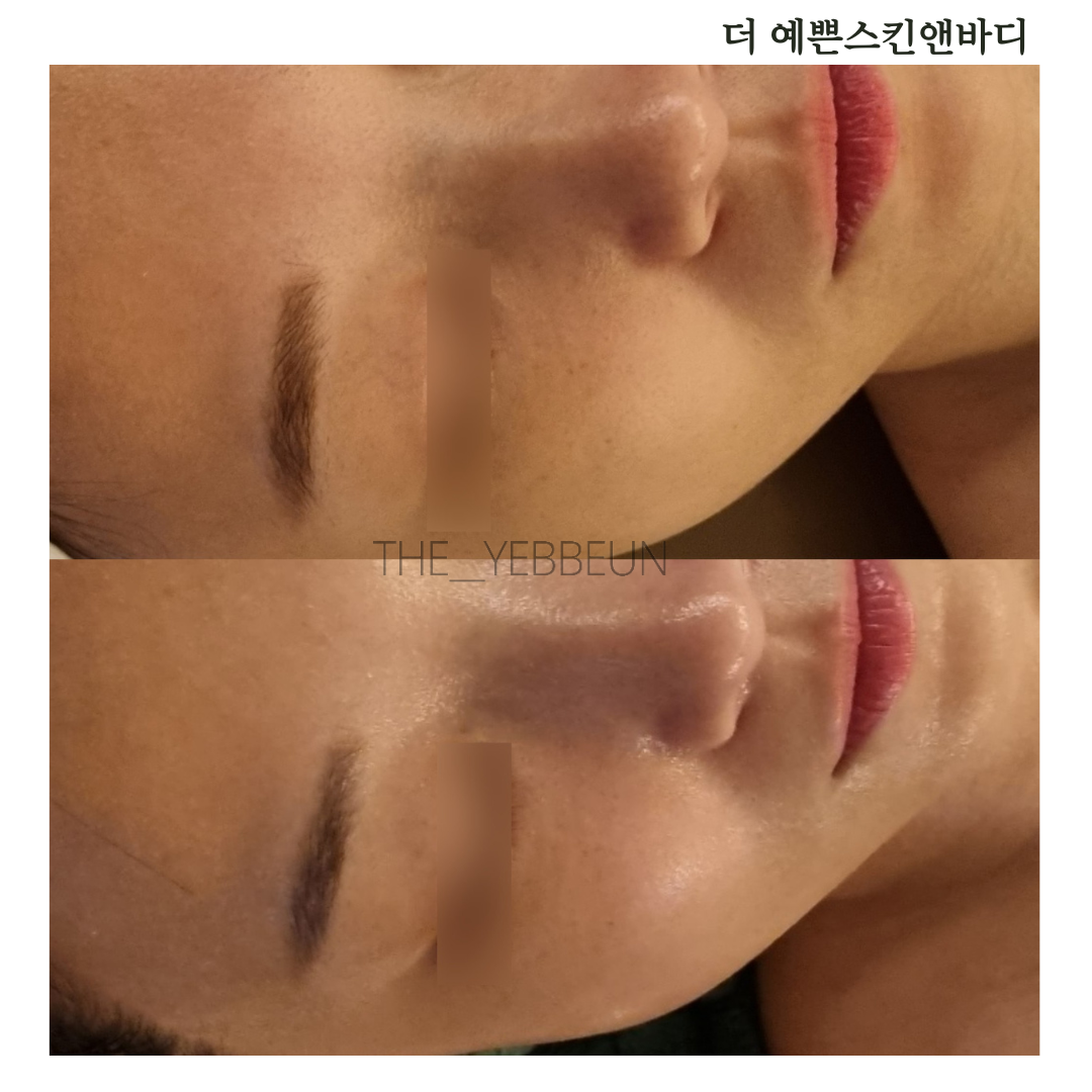 더예쁜스킨앤바디
