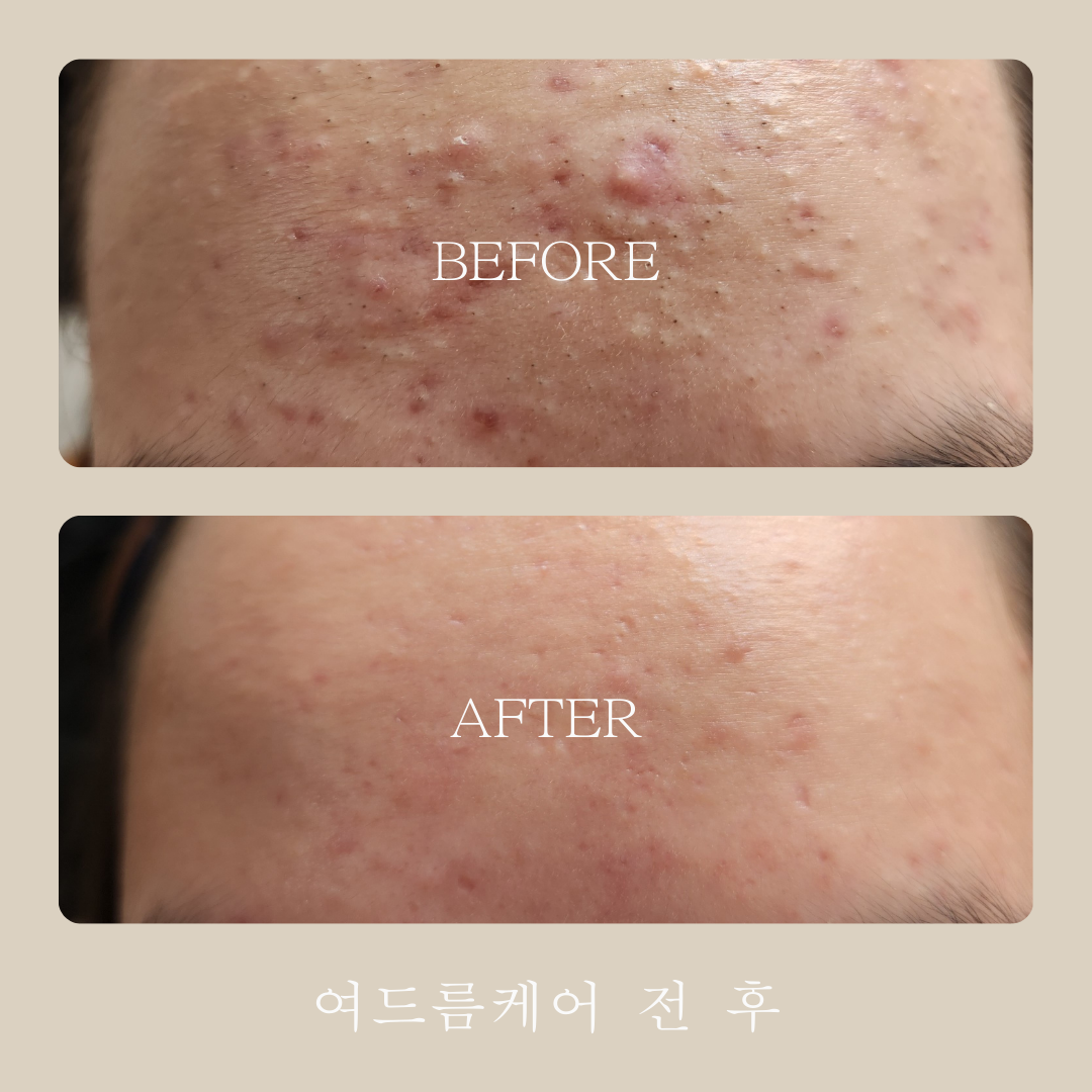 아우라에스테틱 김해삼계점