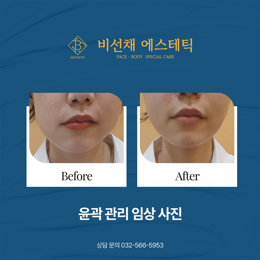비선채 에스테틱 대표 이미지