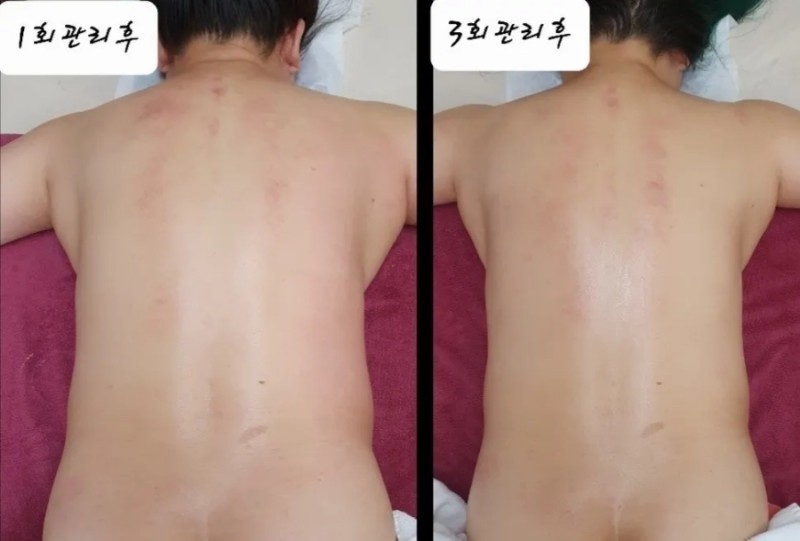 힐링스토리 photo 10