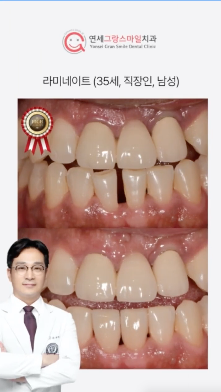 연세그랑스마일 대표 이미지