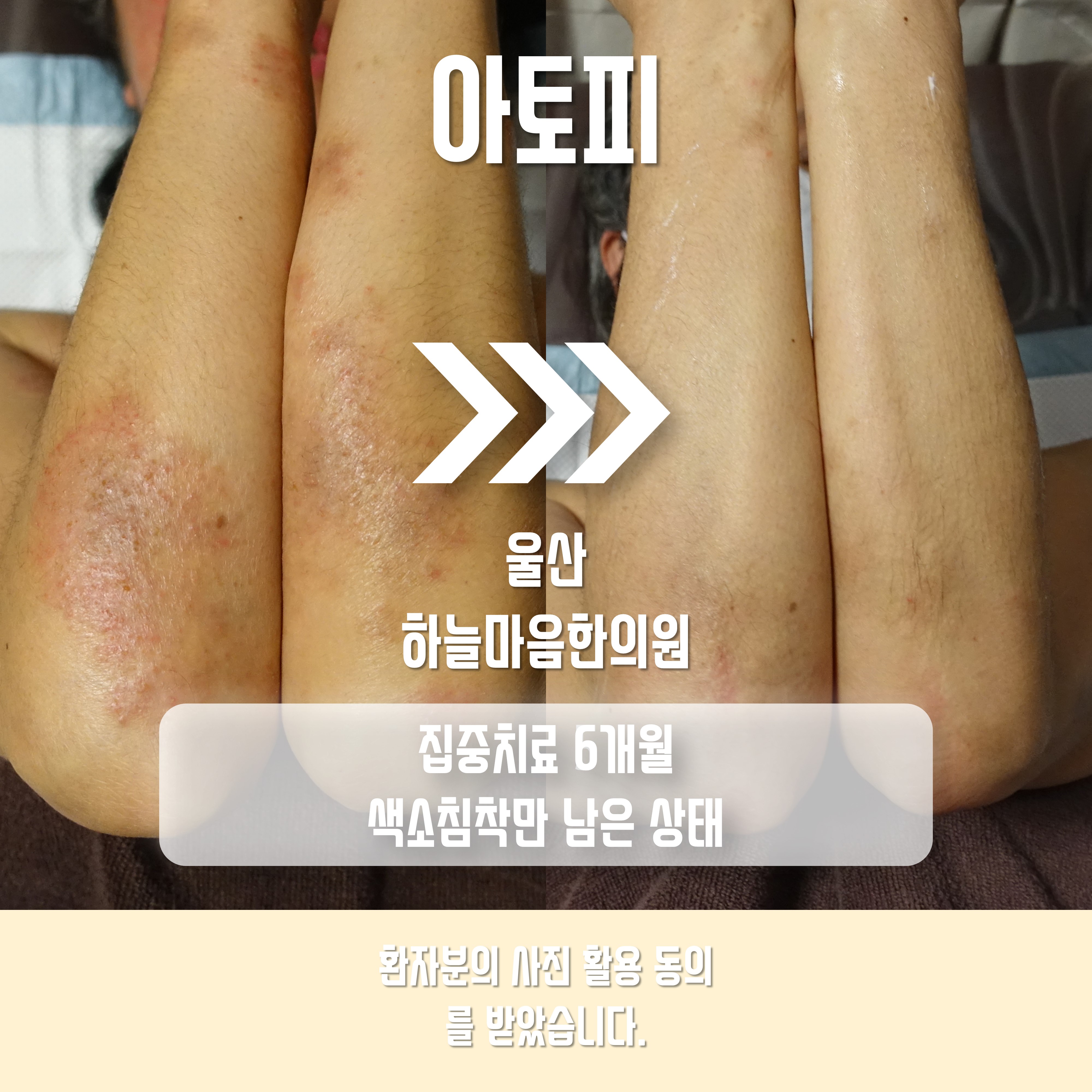 하늘마음한의원 울산점