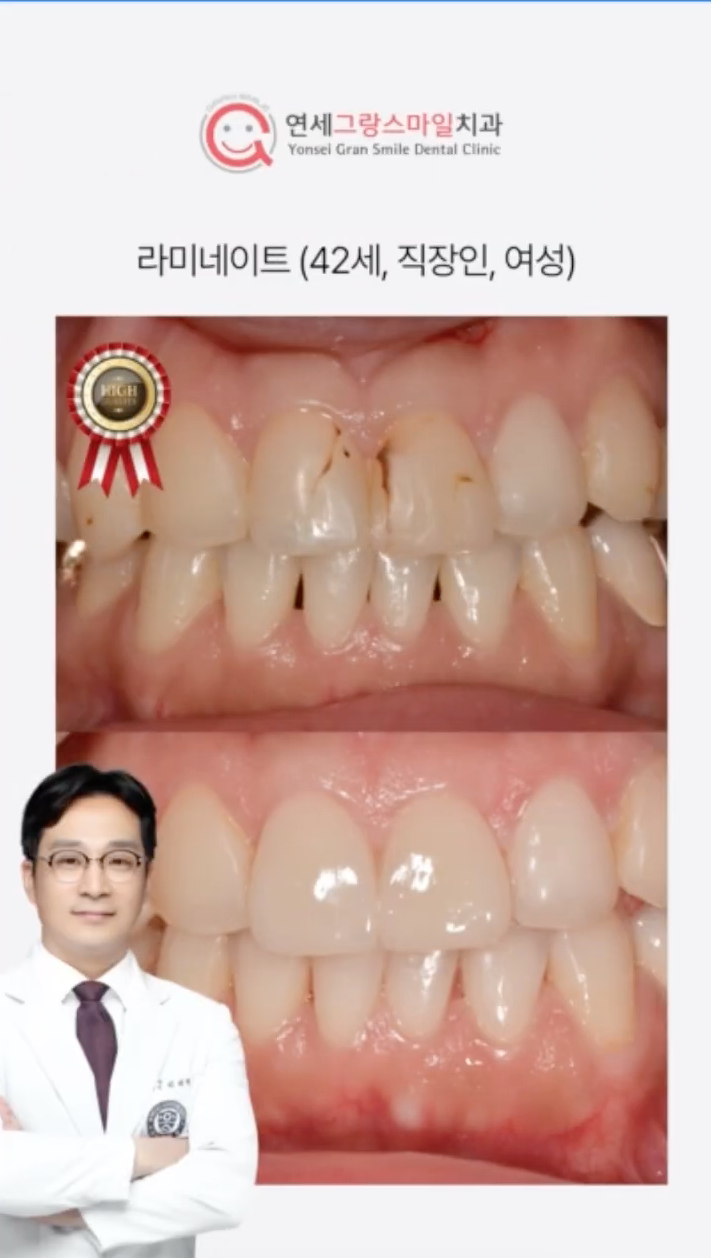 연세그랑스마일치과 대표 이미지