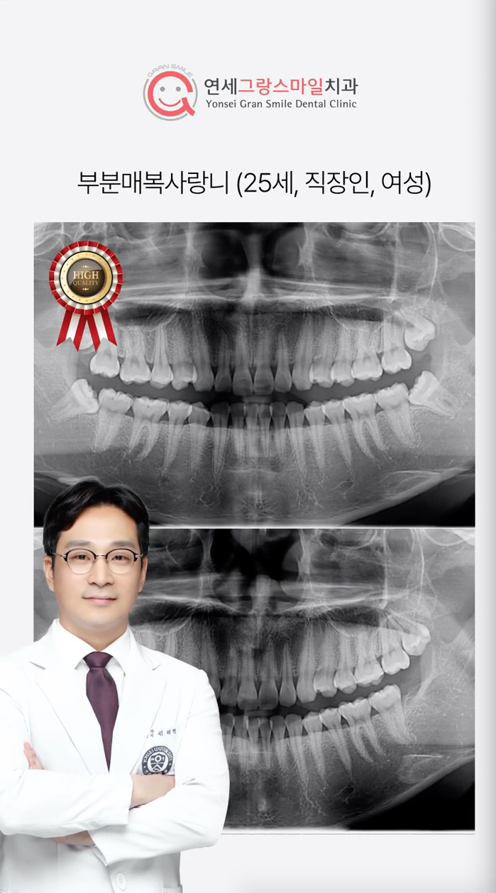 연세그랑스마일치과의원 대표 이미지