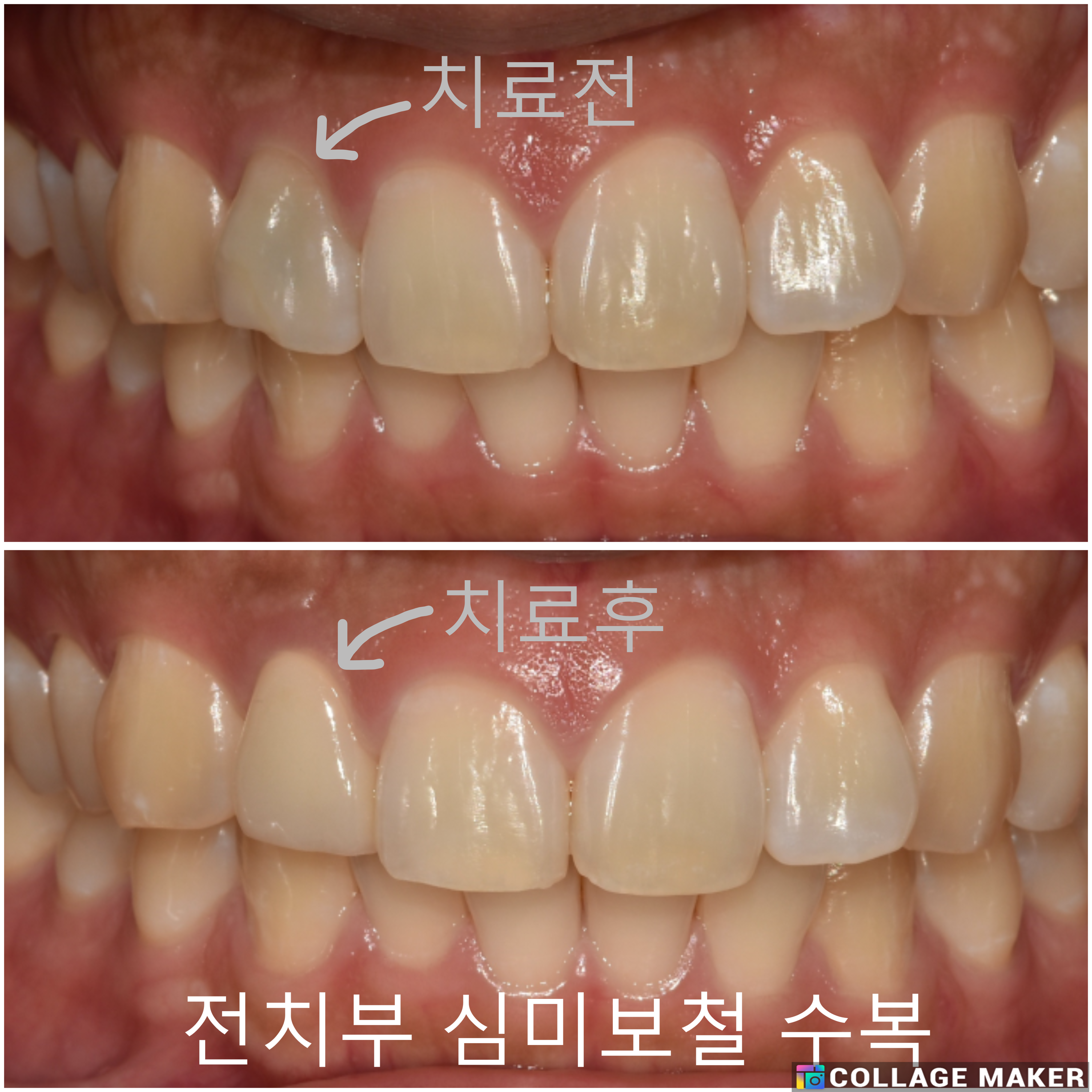 서울바른플란트치과의원 대표 메뉴