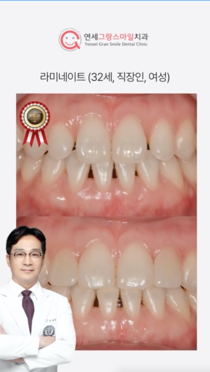 연세그랑스마일치과 이미지