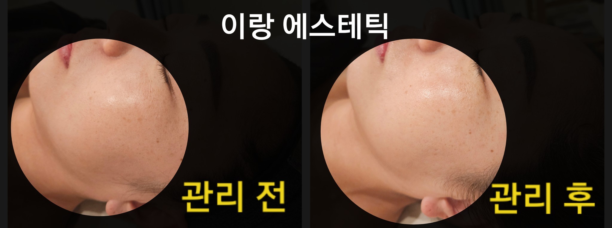 이랑에스테틱 미아본점 대표 이미지