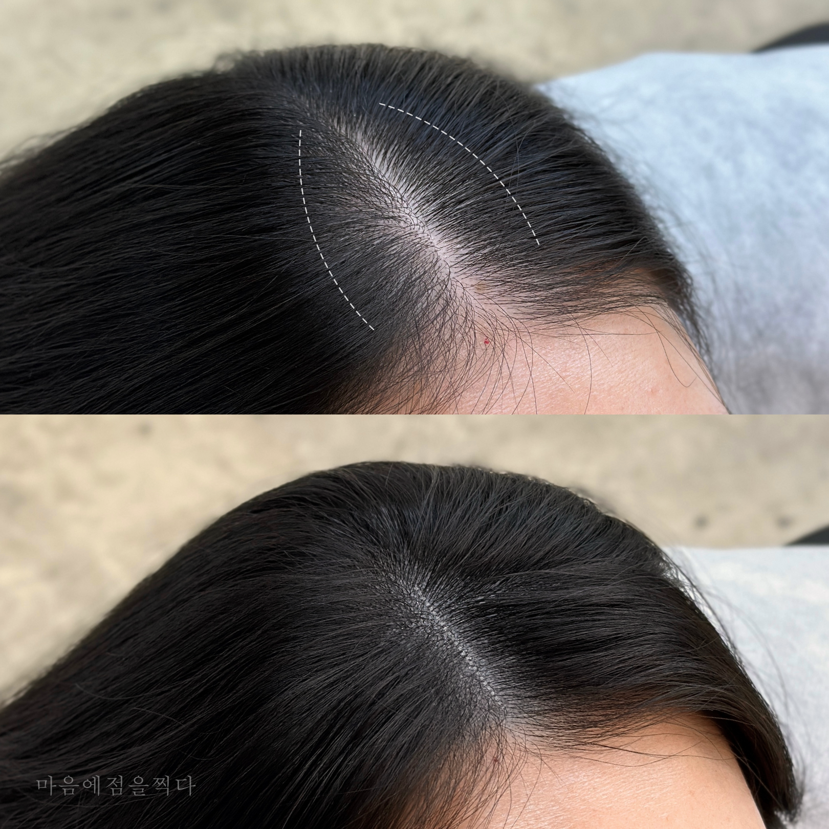 마음에점을찍다 대표 이미지