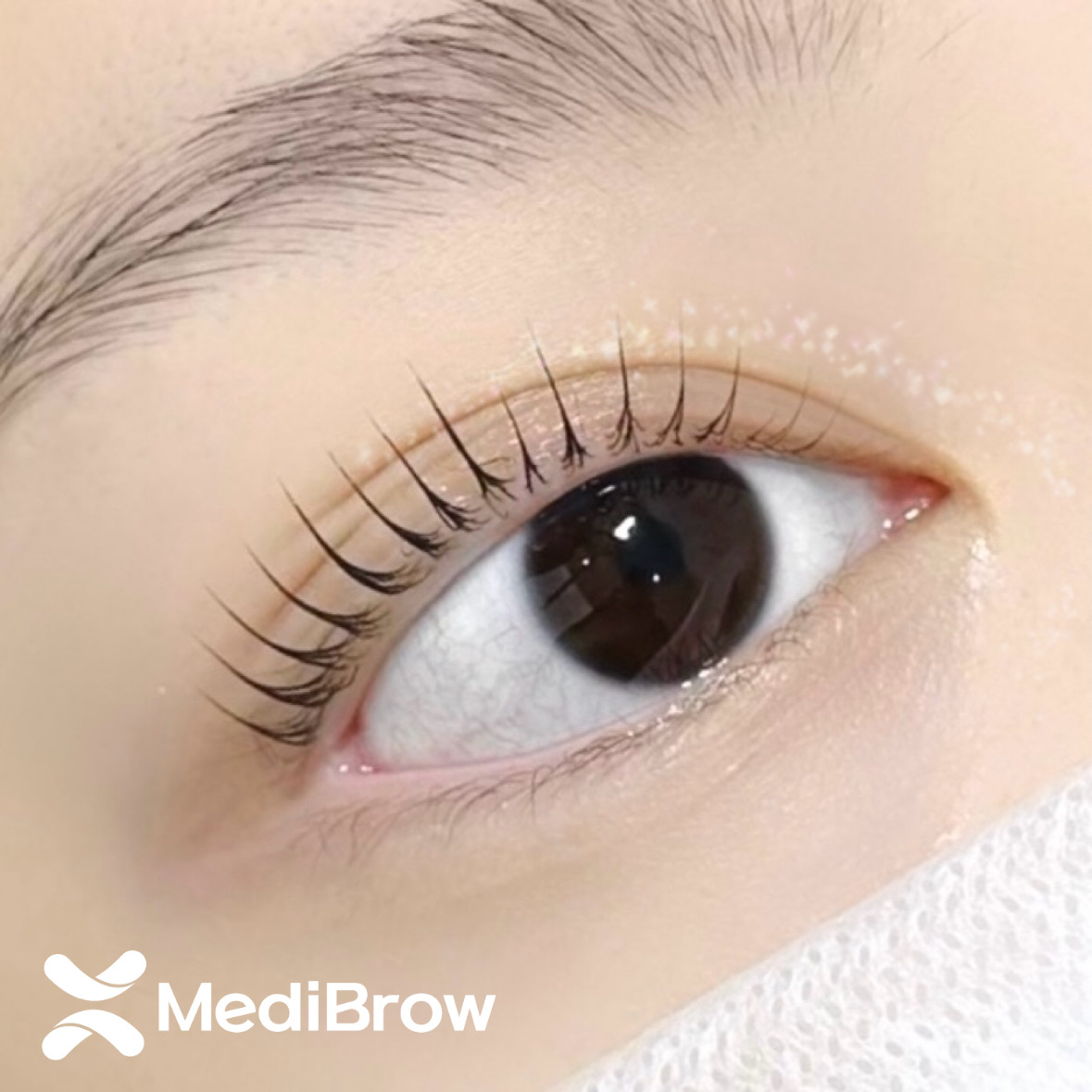 메디브로우 대표 이미지