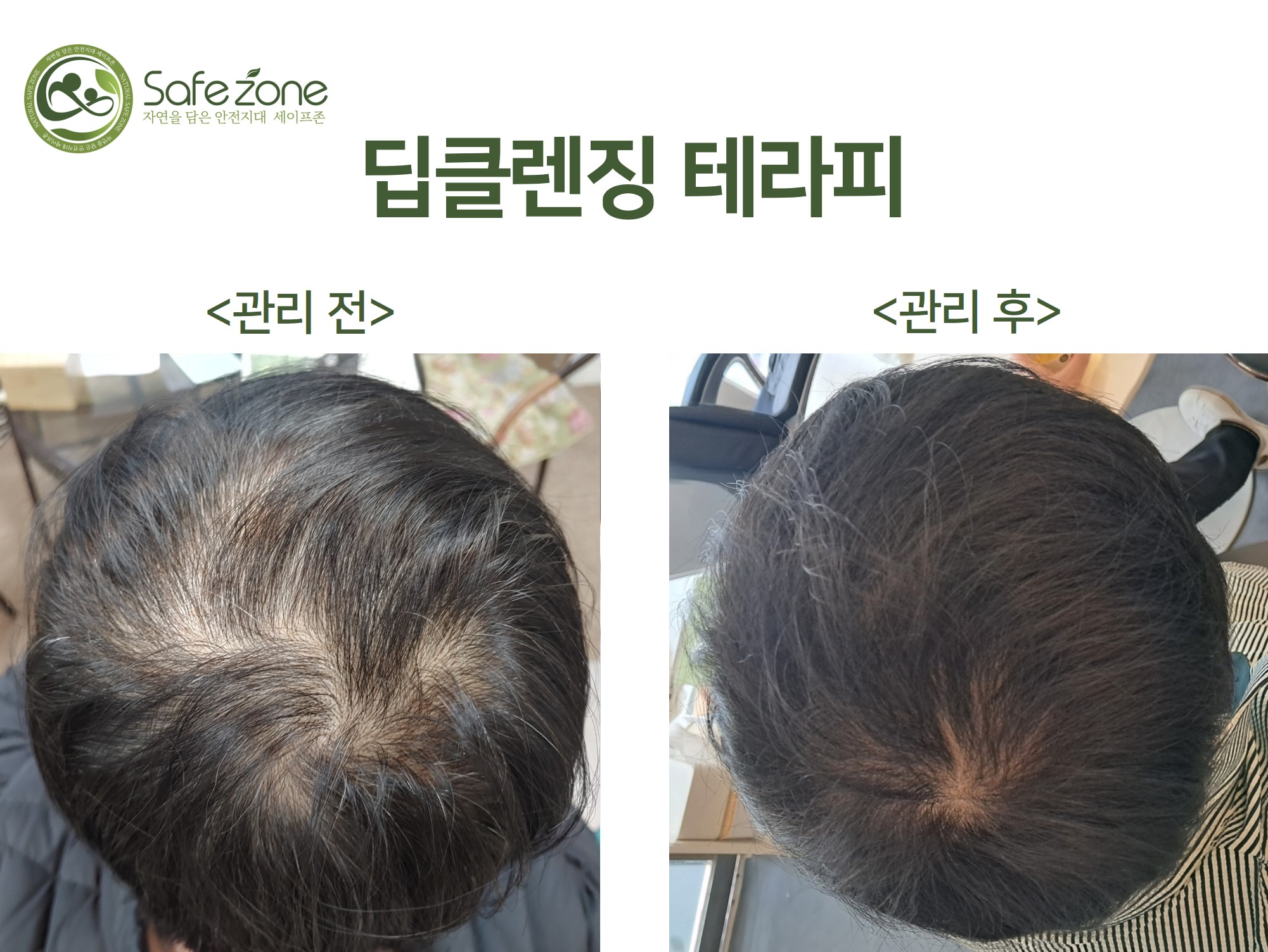 세이프존 액손알앤디 대표 이미지