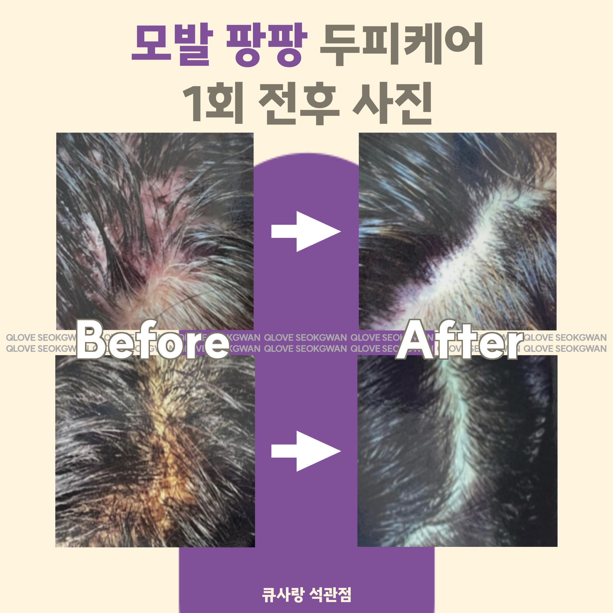 큐사랑 석관점