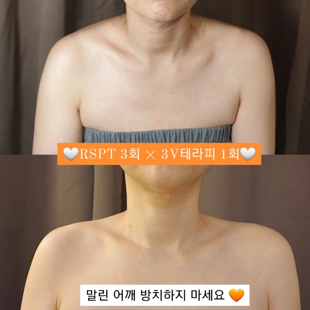 아벨라뷰티 대전본점