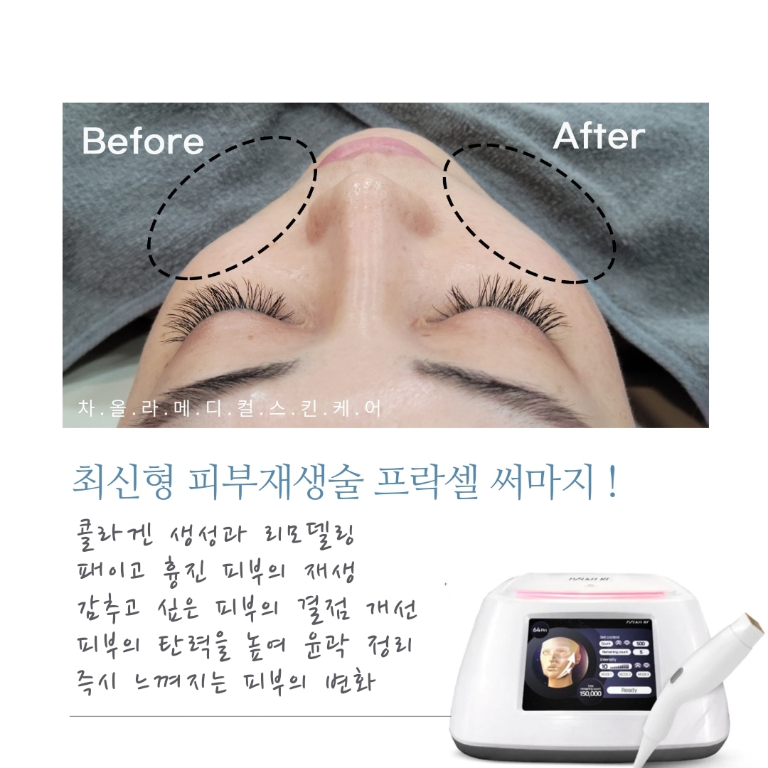 차올라메디스킨 대표 이미지