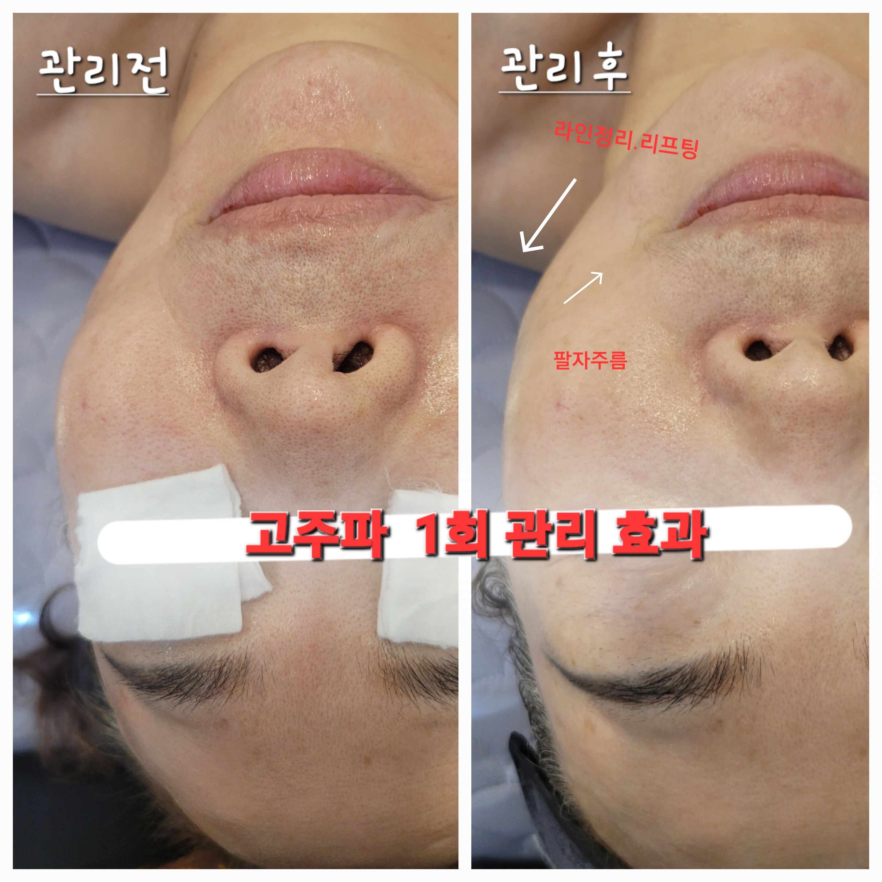 라아뷰티 대표 이미지