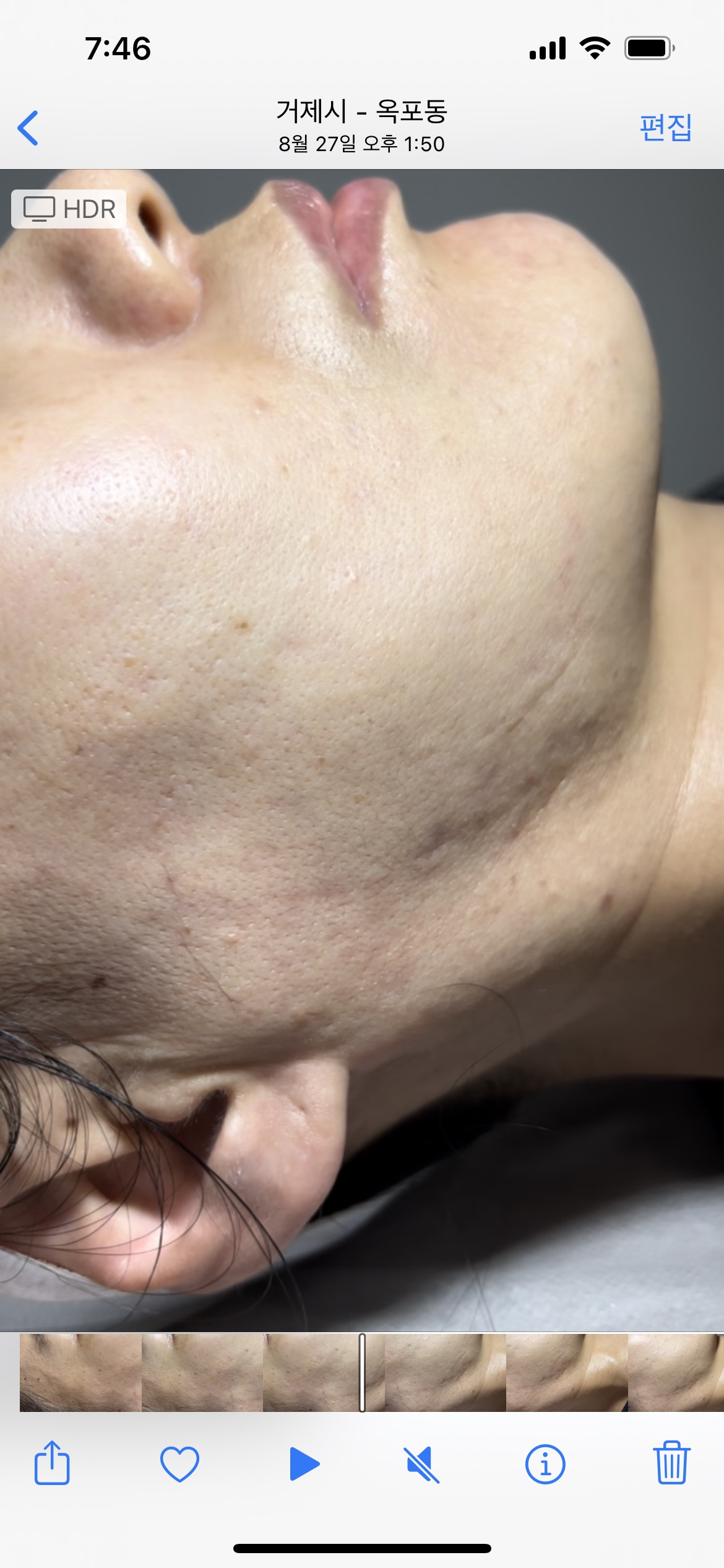 제로스킨 홍대 대표 이미지