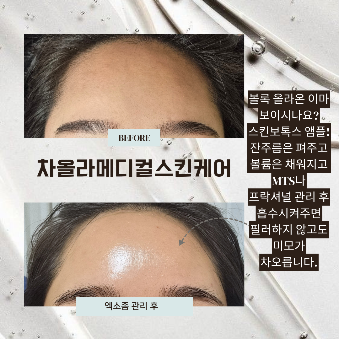 차올라메디스킨 대표 이미지