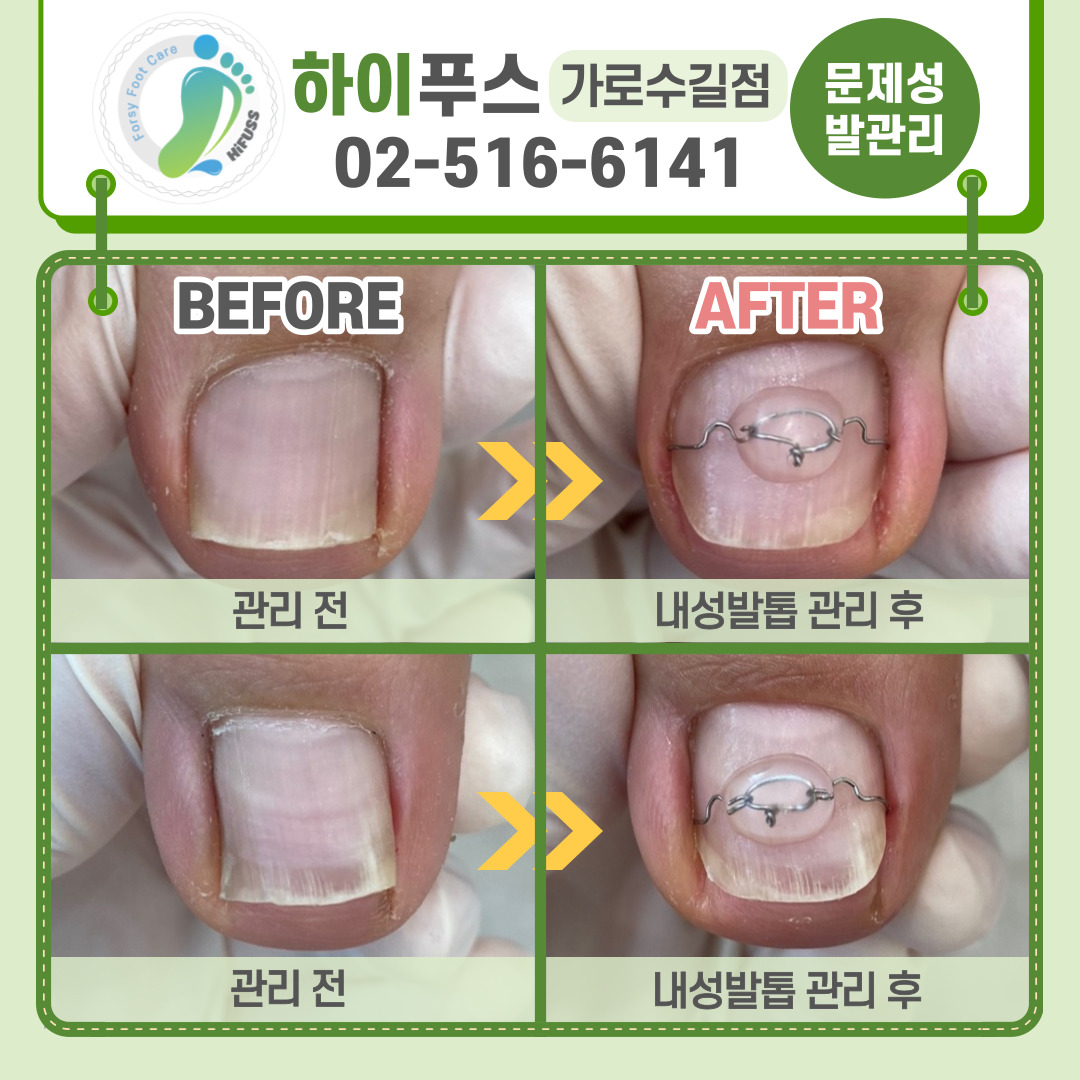 포쉬네일 하이푸스 가로수길점