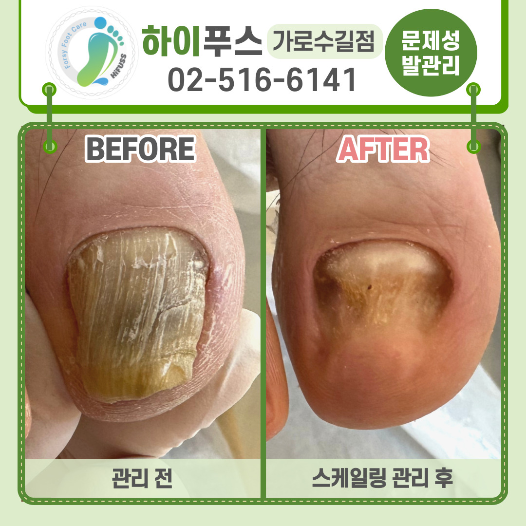 포쉬네일 하이푸스 가로수길점