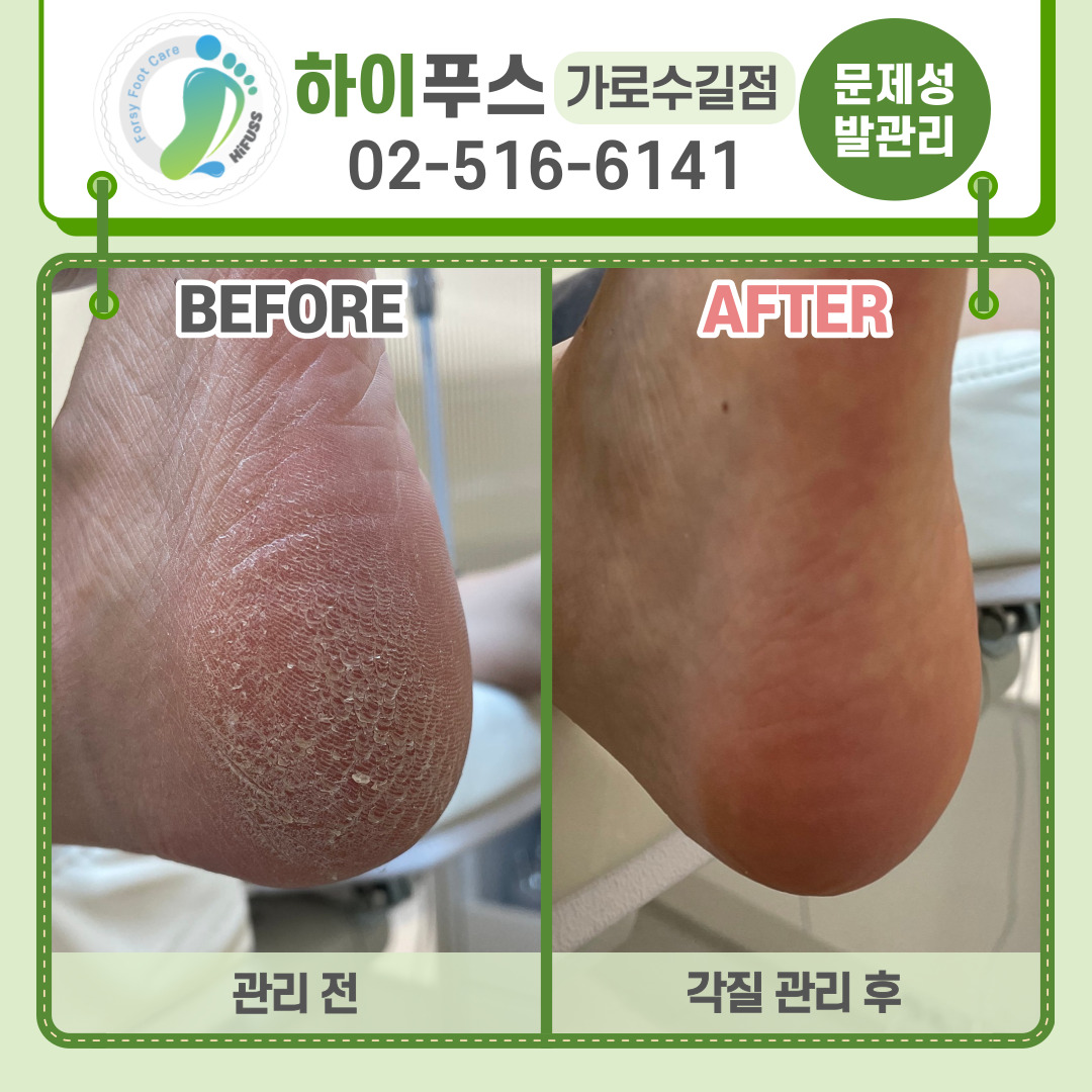 포쉬네일 하이푸스 가로수길점
