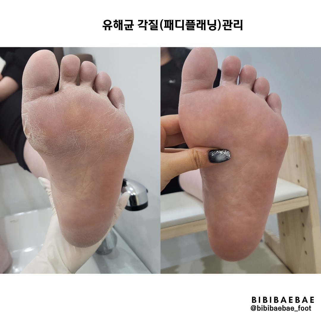 비비배배