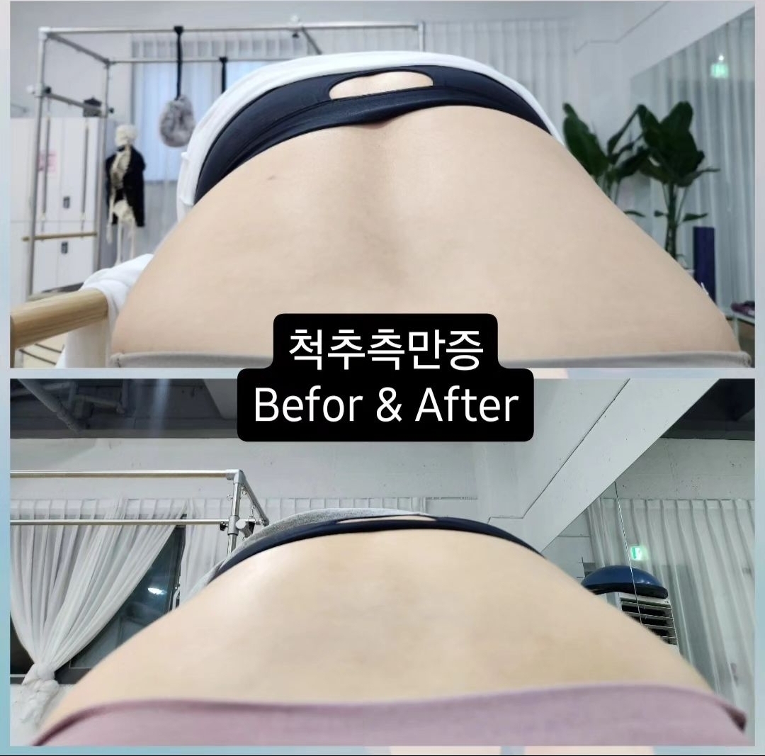 시그니처요가&필라테스 강릉중앙점 대표 이미지