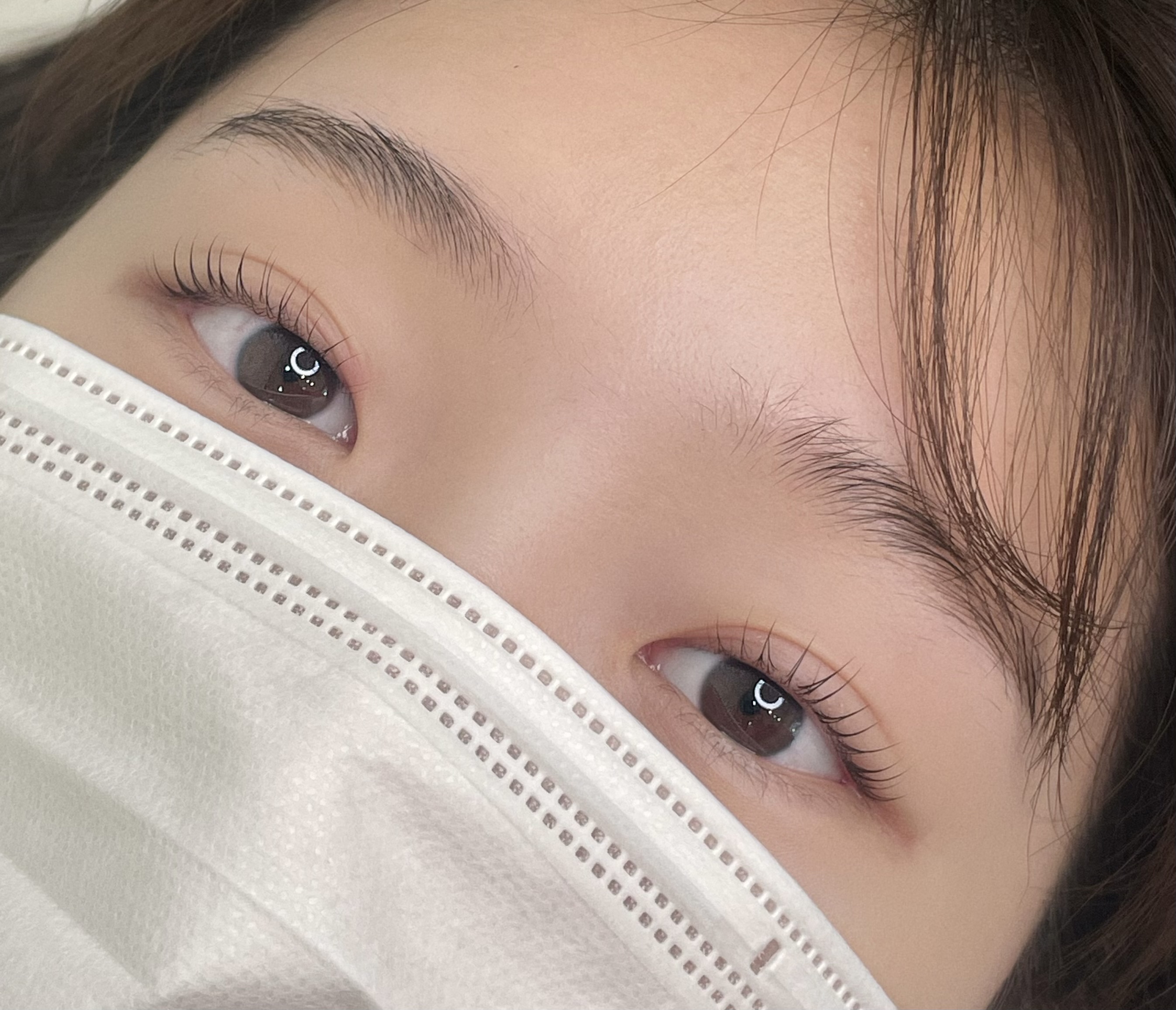 요니네일