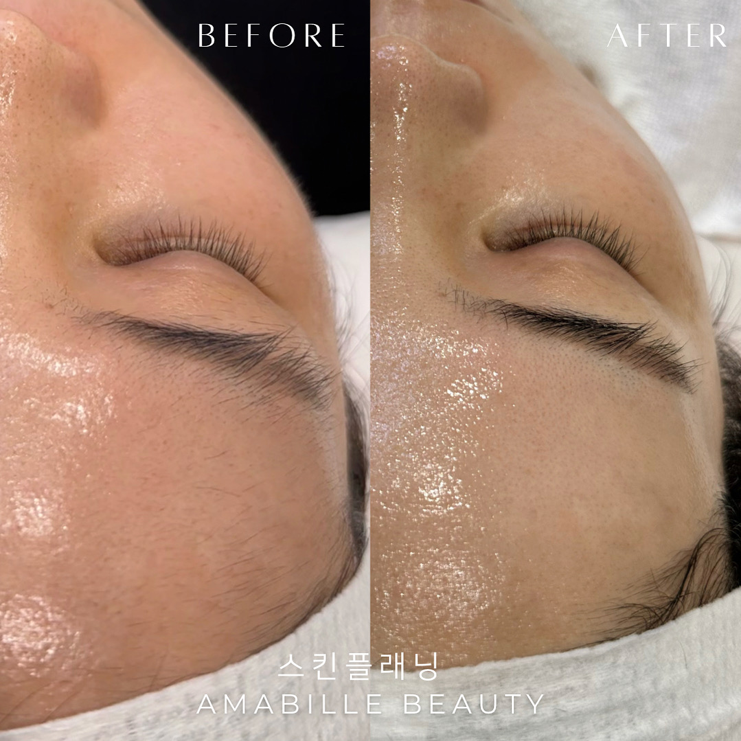 아마빌레뷰티 대표 이미지