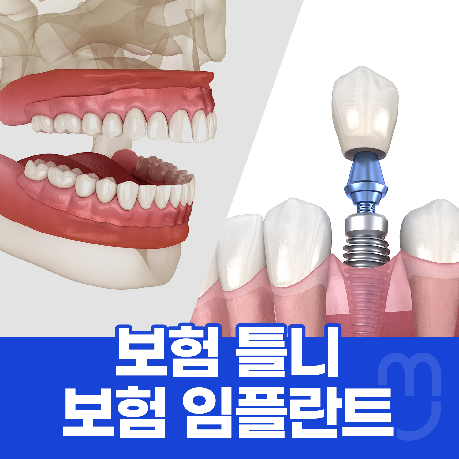 미소진치과의원 대표 이미지