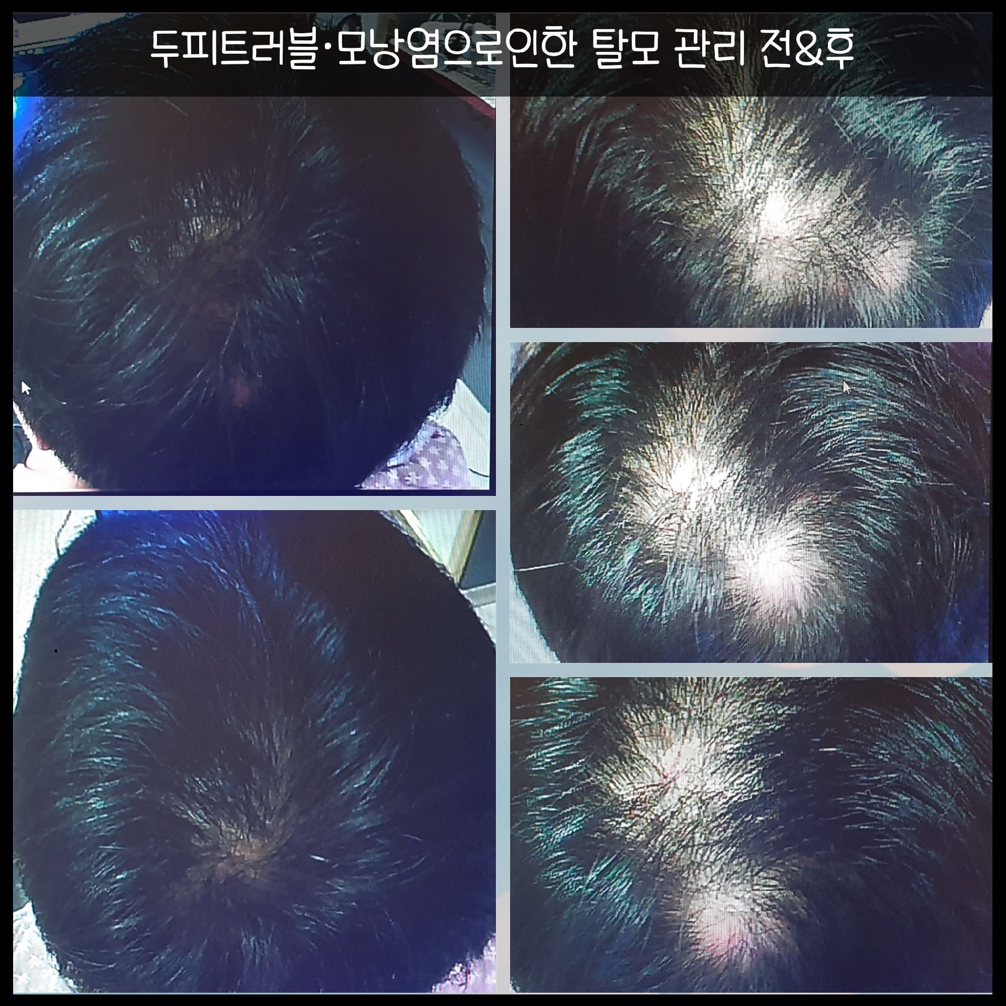 서주은두피센터