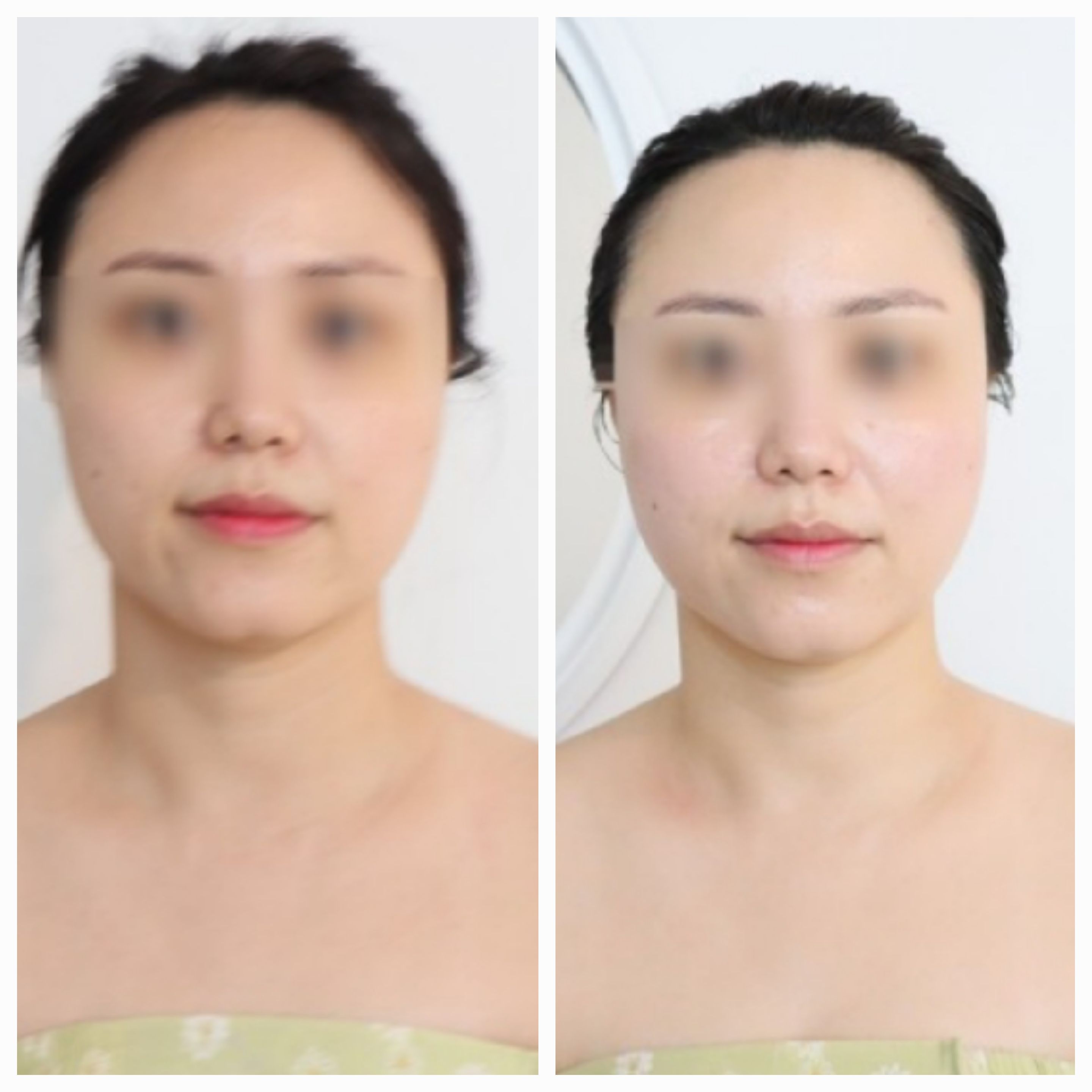 예쁨토탈뷰티샵 photo 7