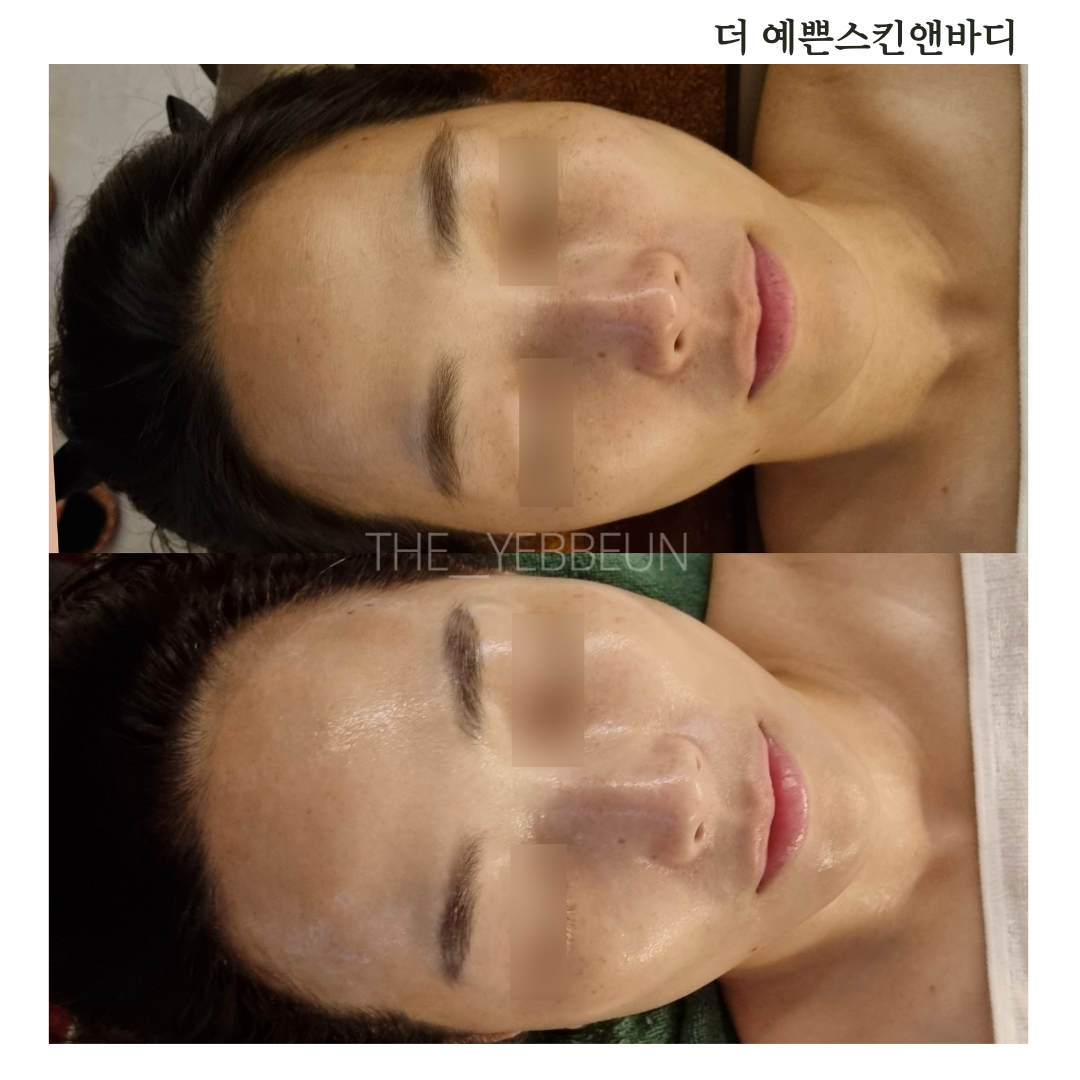 더예쁜스킨앤바디