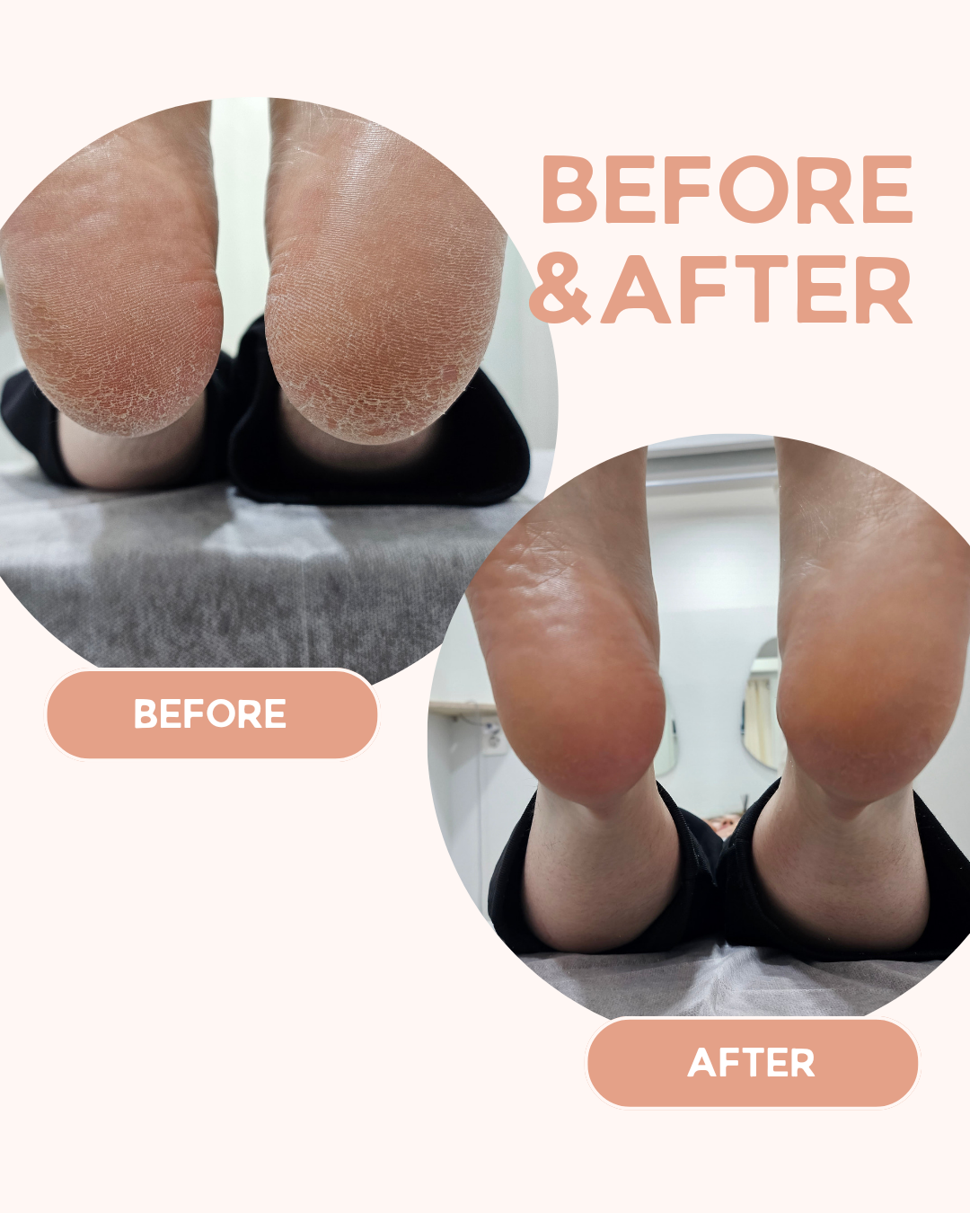 리턴스킨 대표 이미지