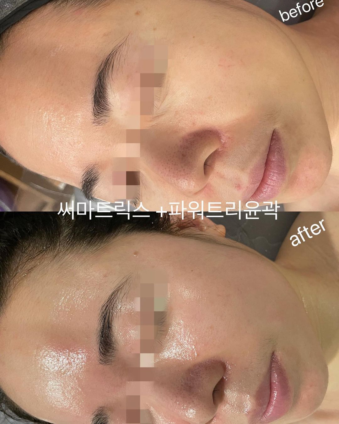봄에스테틱피부관리 수원본점 대표 이미지