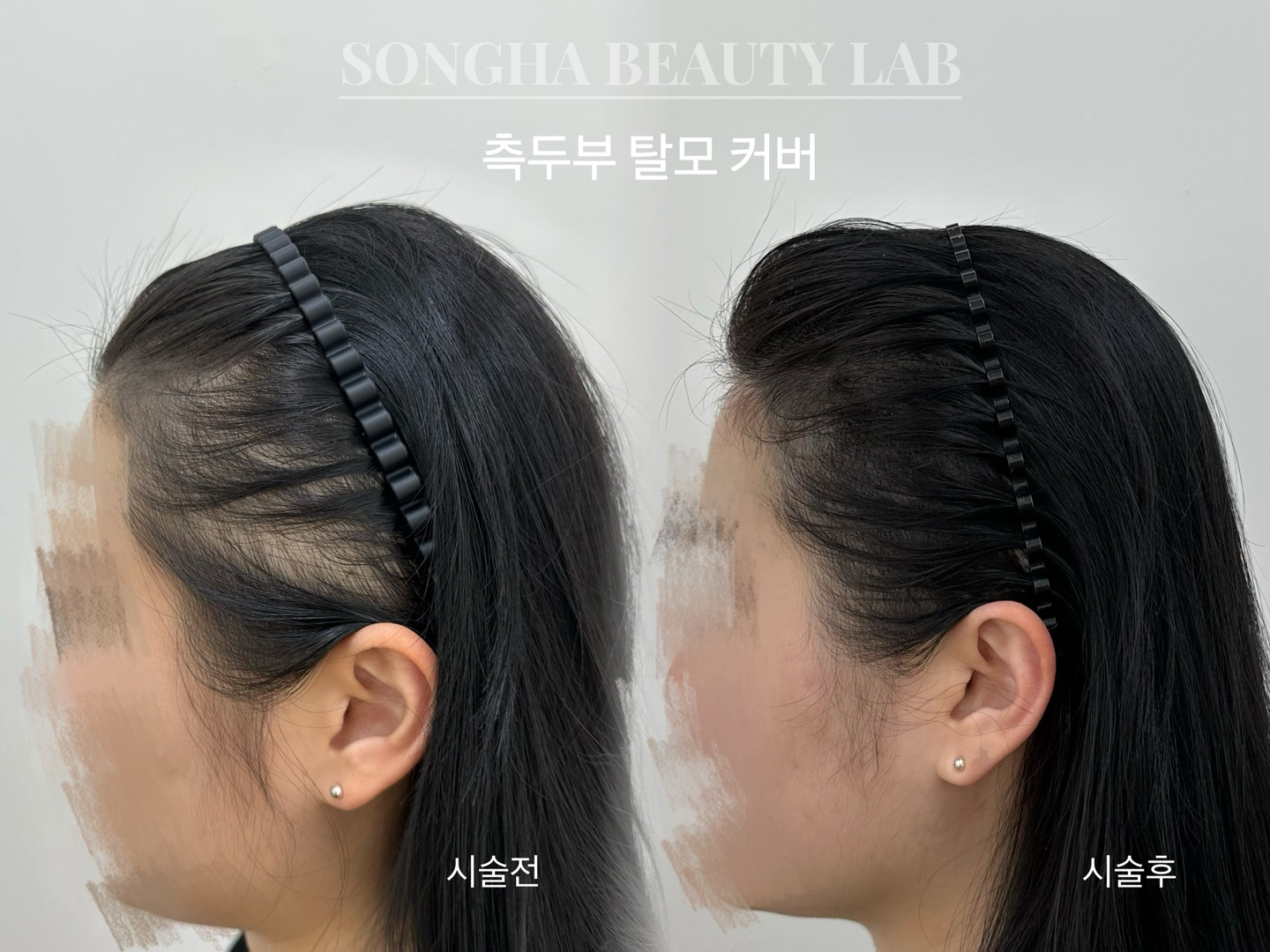 송하뷰티랩