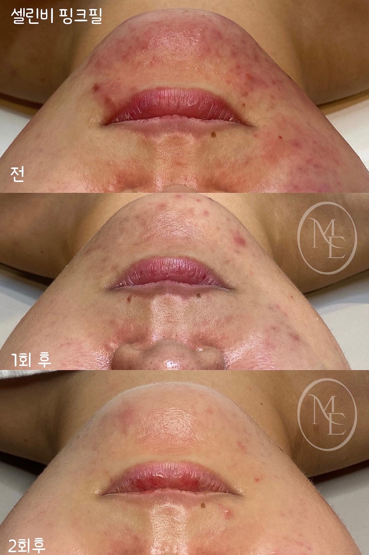 메이에르 헤어&에스테틱