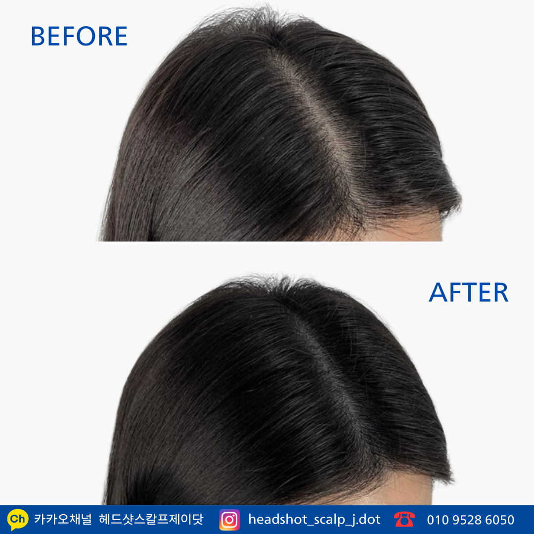 헤드샷스칼프제이닷 대표 이미지