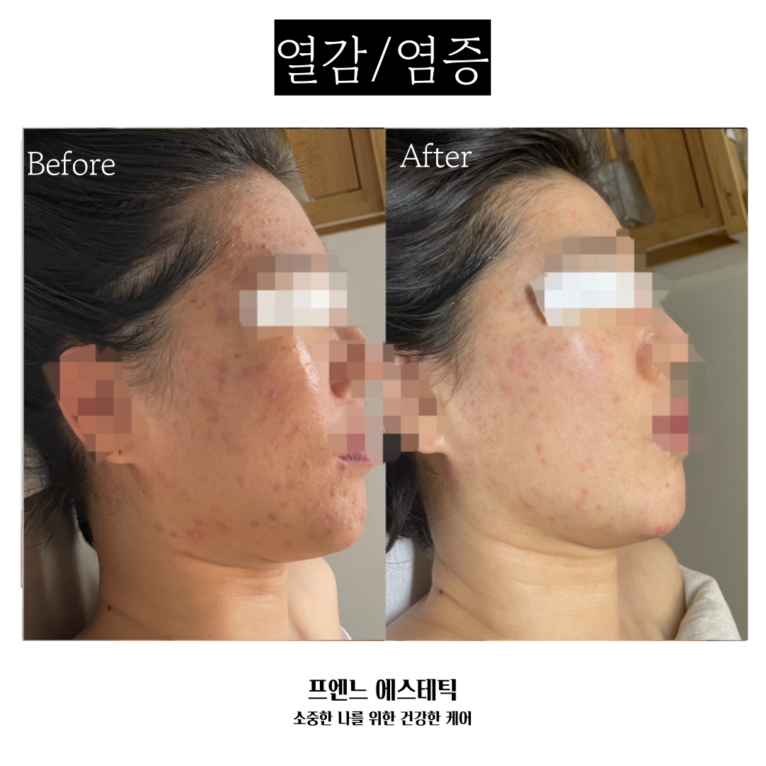 라온제이 에스테틱