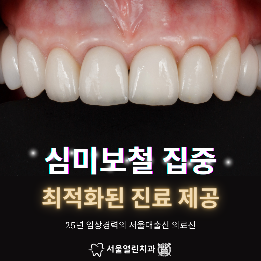 서울열린치과의원 대표 이미지