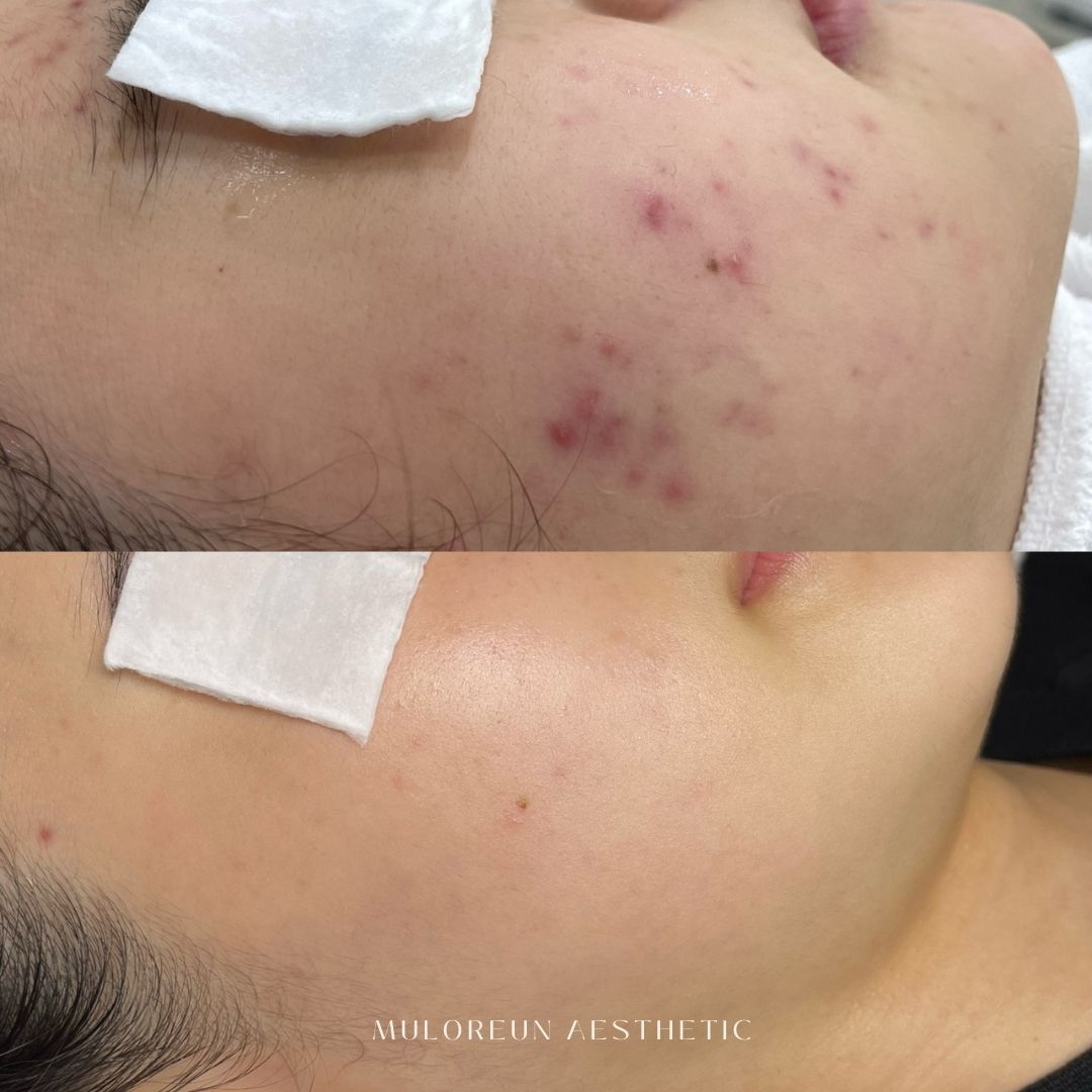 물오른더예쁨 대표 이미지