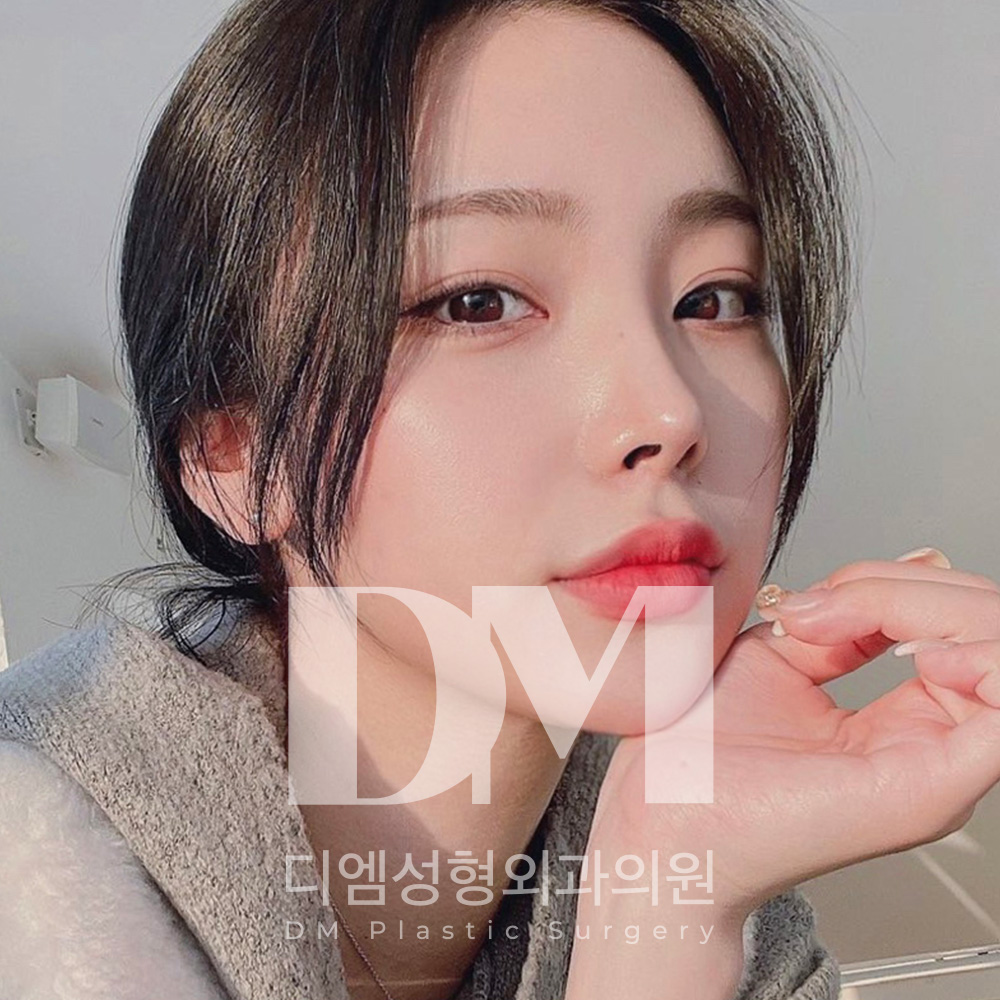 디엠성형외과의원 대표 이미지