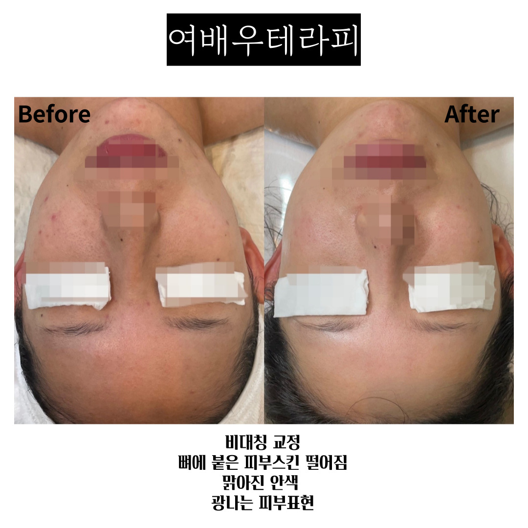 라온제이 에스테틱