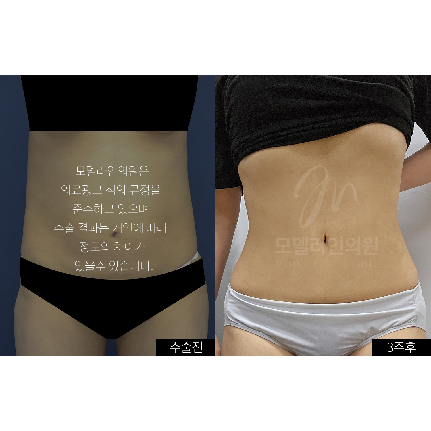 모델라인의원 강남점 대표 이미지