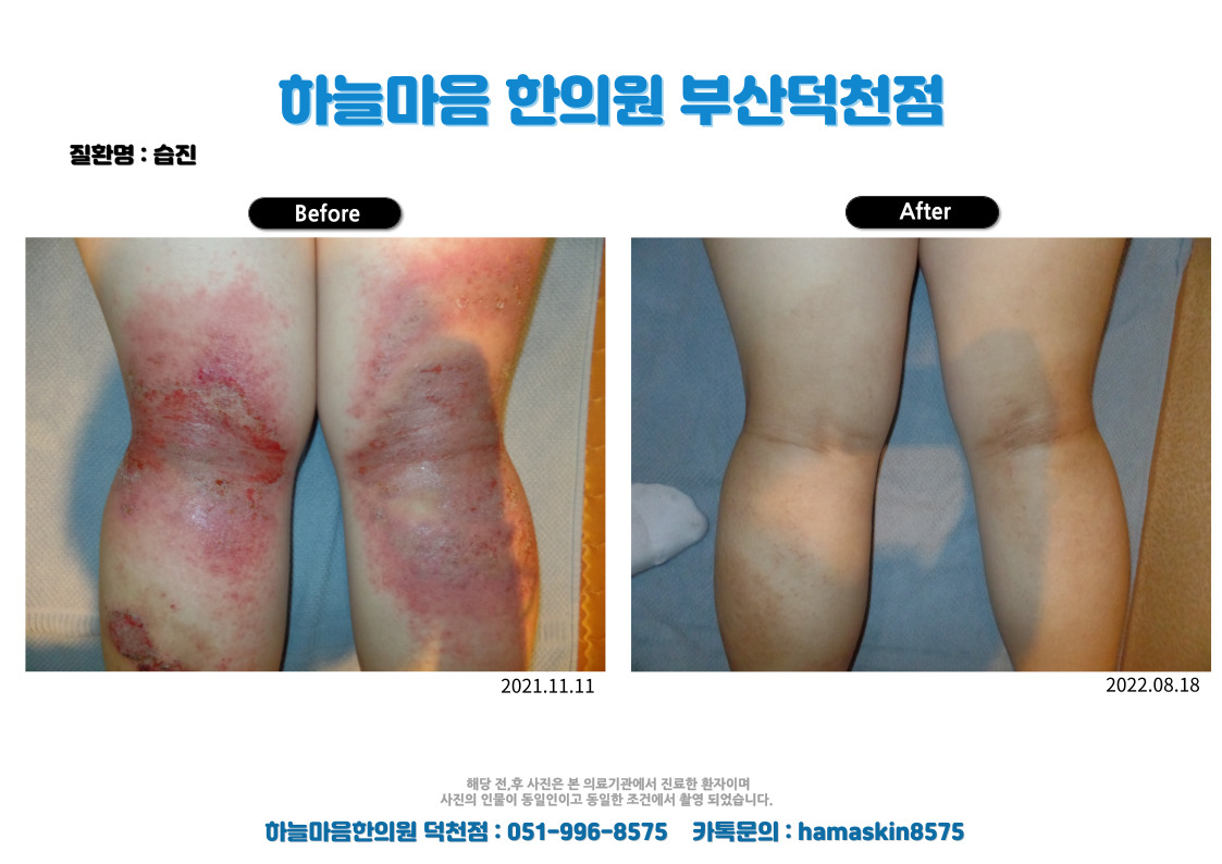 하늘마음한의원 부산덕천 대표 이미지
