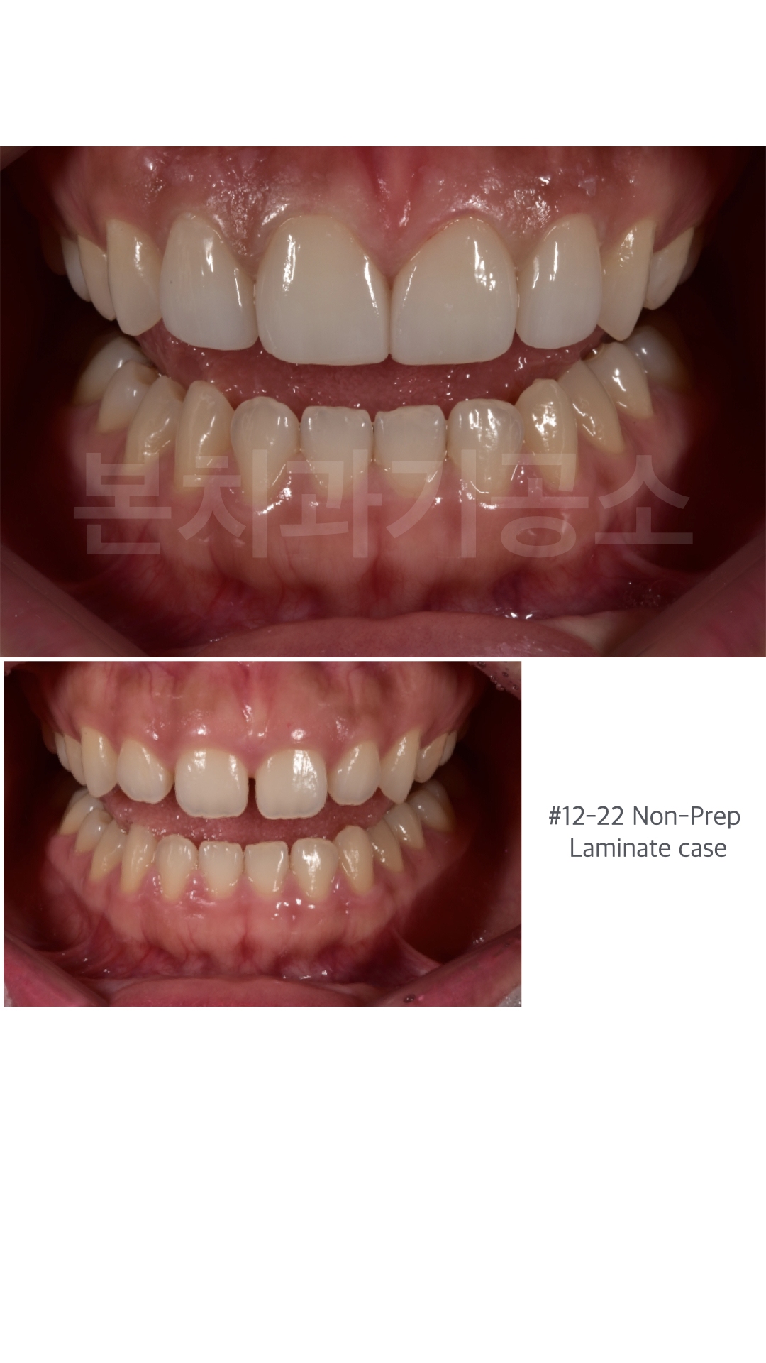 본치과기공소 대표 이미지