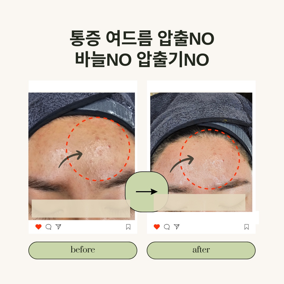 레젤스킨앤바디