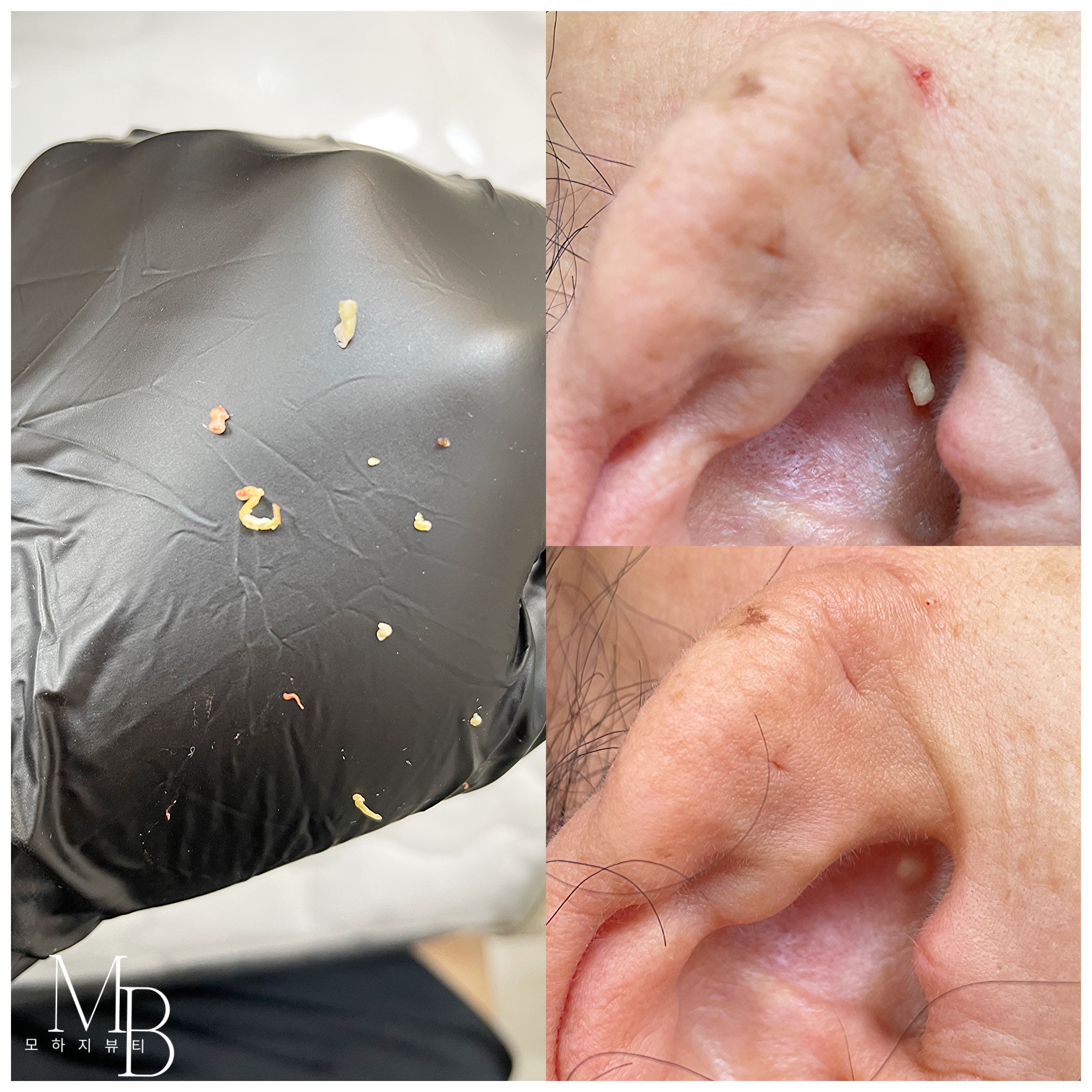 스킨코디 대표 이미지