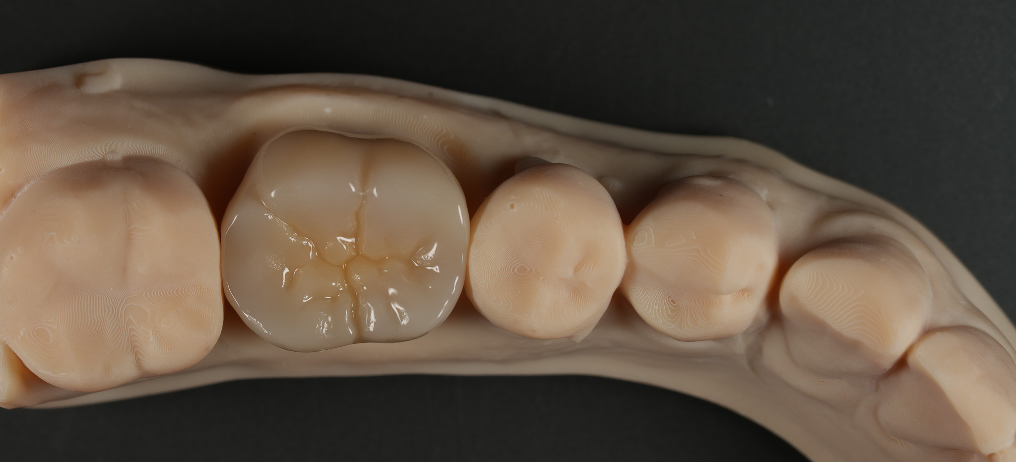 본치과기공소 대표 이미지