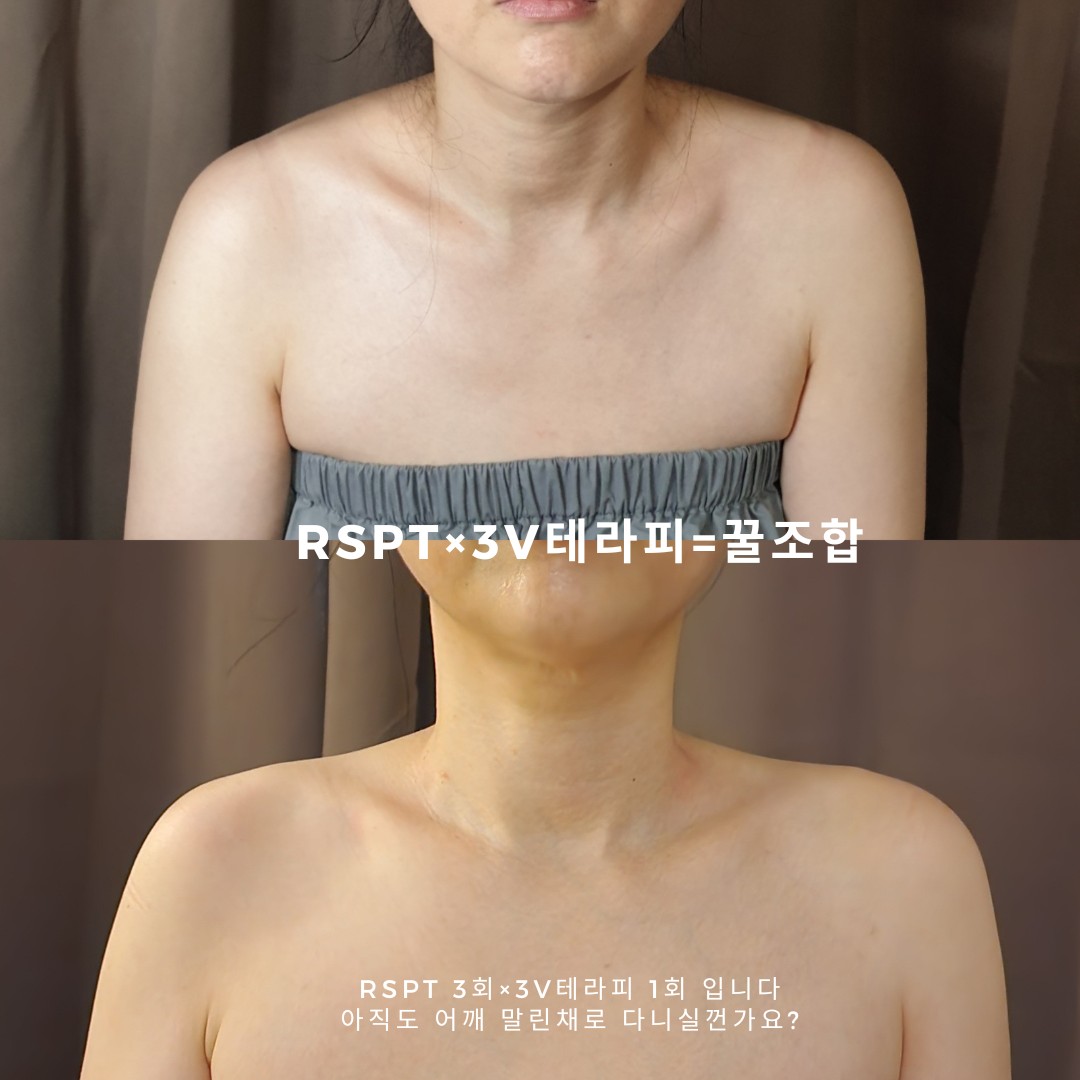 미올뷰티&피부관리&속눈썹펌 다산본점