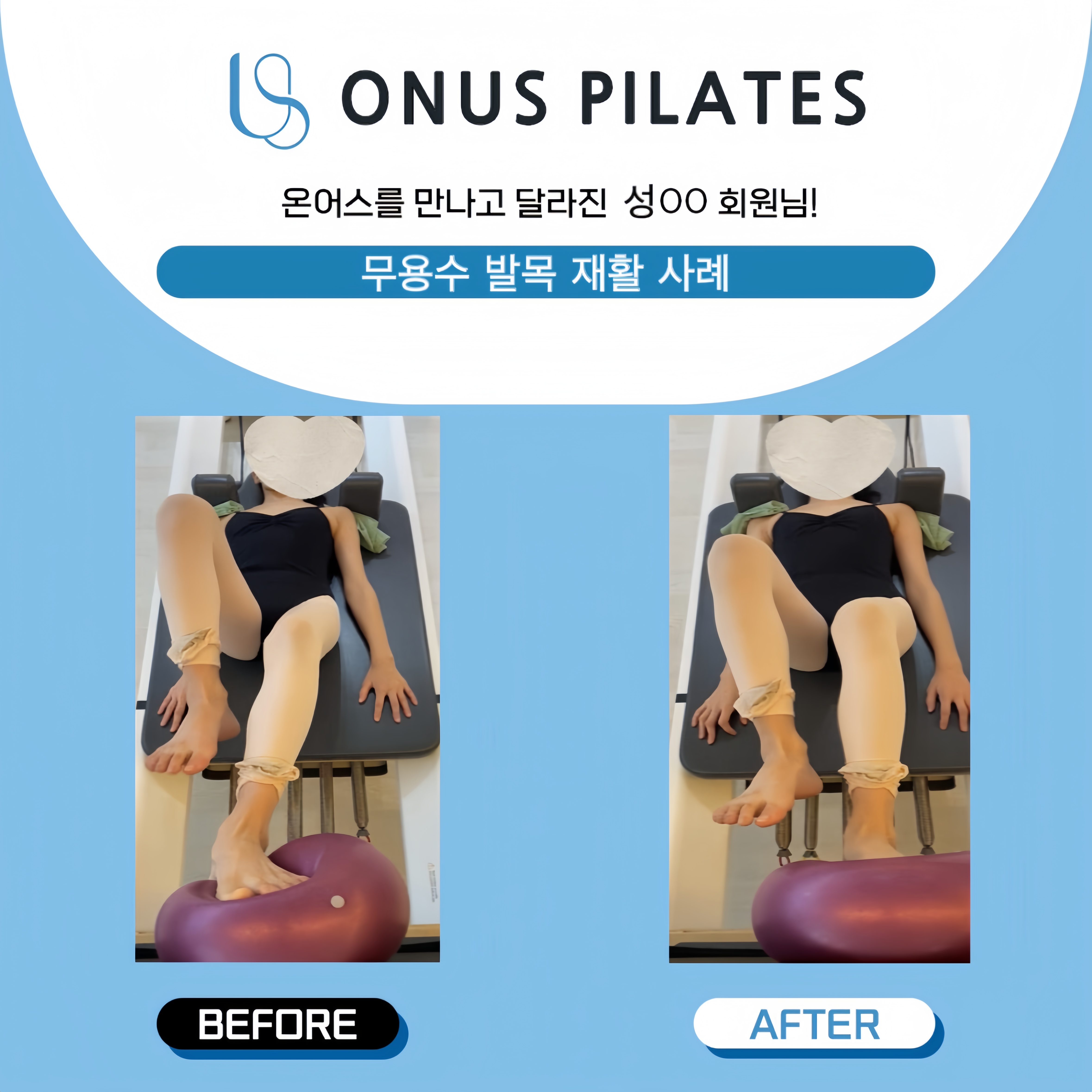 온어스필라테스 재활운동 체형교정 세종아름점