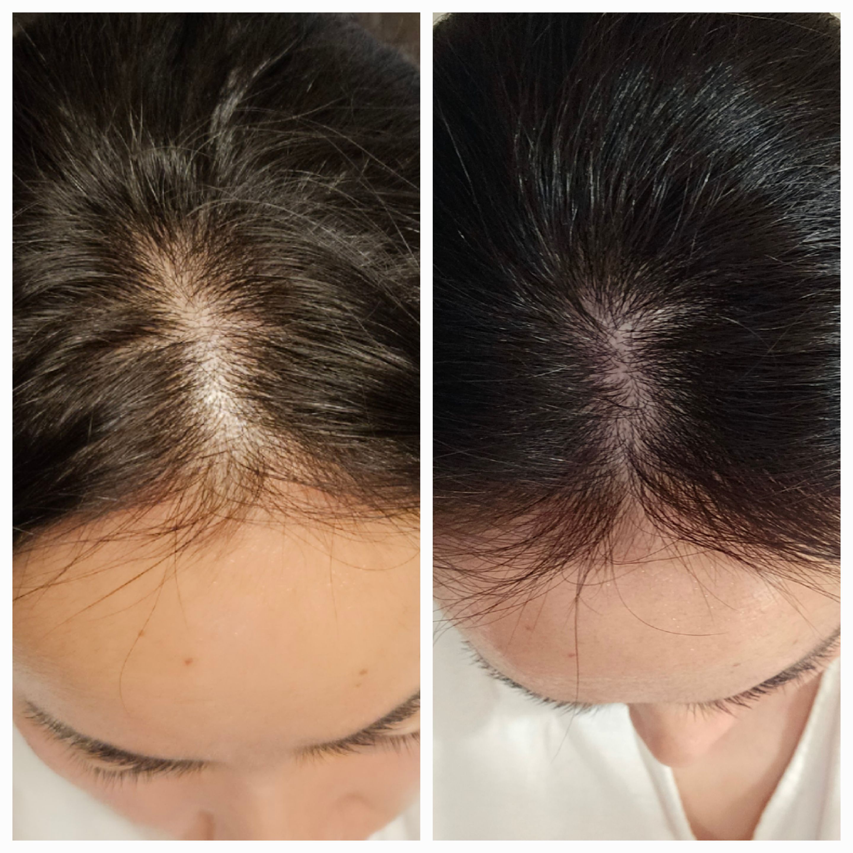 인셀덤글로벌리더 대표 이미지